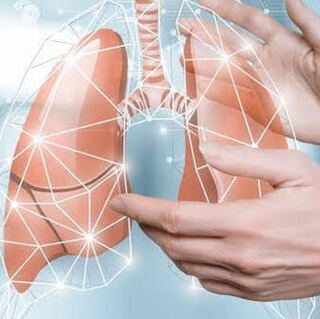 Akciğer Zarı (Plevral) Hastalıkları ve Plevral Effüzyon